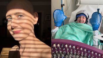 Monika Mikuła kilka tygodni temu zaniepokoiła fanów zdjęciem ze szpitala. Teraz aktorka pokazała się bez włosów (FOTO)