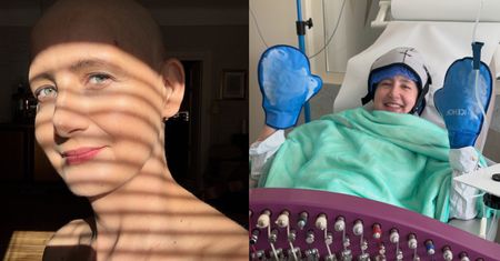 Monika Mikuła kilka tygodni temu zaniepokoiła fanów zdjęciem ze szpitala. Teraz aktorka pokazała się bez włosów (FOTO)