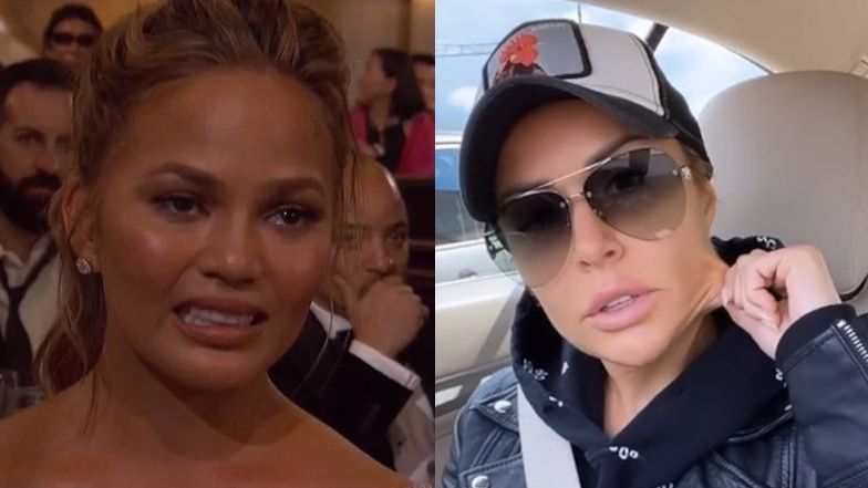 Chrissy Teigen wycięła sobie torebki tłuszczowe z policzków