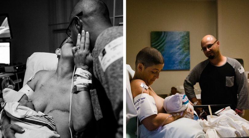 Cesarskie cięcie kończy się sukcesem