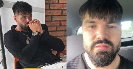 TYLKO NA PUDELKU: Kosmetolog odpowiada na oskarżenia Pawła Tyburskiego: "Jest osobą UZALEŻNIONĄ od zabiegów. To nie twarz zaczęła mu się zapadać, TYLKO PSYCHIKA"