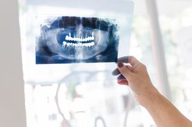 Zdjęcie pantomograficzne zębów – cena, wskazania i przeciwwskazania