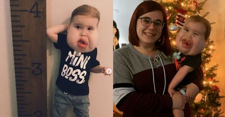 Gavin urodził się z rzadką chorobą. Jego mama chce, by miał normalne dzieciństwo