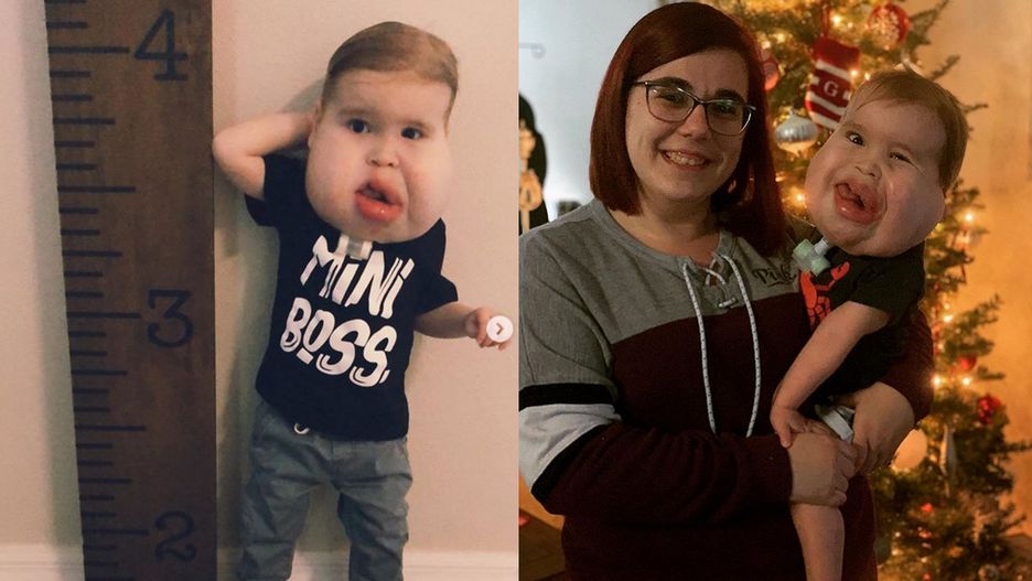 Gavin urodził się z rzadką chorobą. Jego mama chce, by miał normalne dzieciństwo