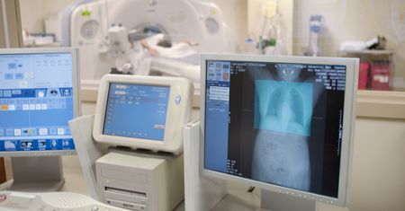 Nowe darmowe badanie. Przeznaczone głównie dla osób w wieku 55-74