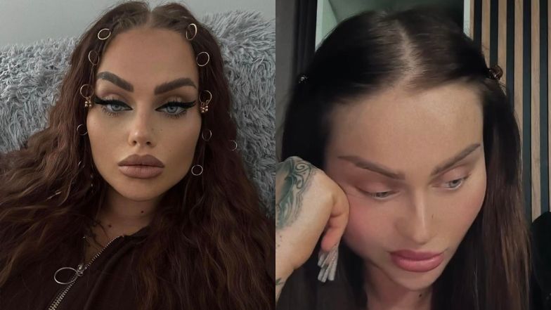 Ewel0na walczyła o życie. Pokazała blizny