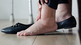 Latem puchną ci stopy? Dietetyk mówi, czego unikać
