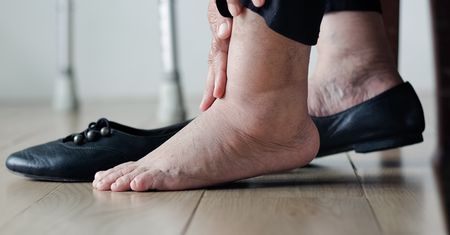 Latem puchną ci stopy? Dietetyk mówi, czego unikać
