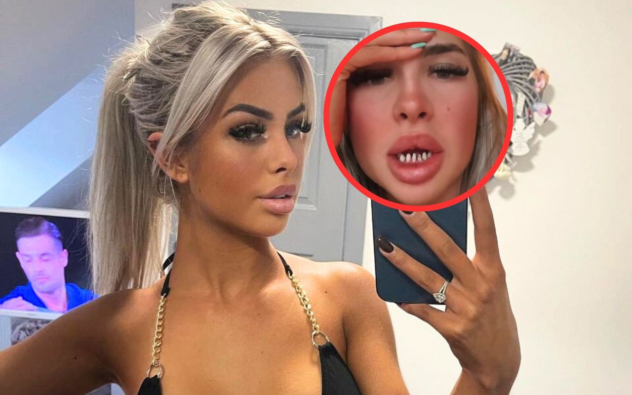 She got "Turkish teeth" and showed them off online, prompting shock from followers