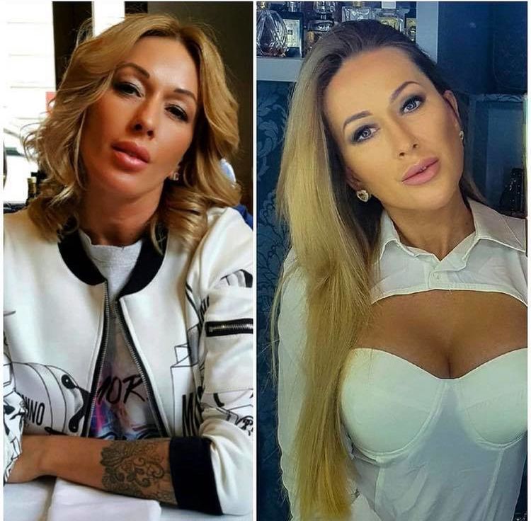 Sylwia Peretti odwiedza gabinet medycyny estetycznej