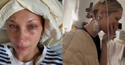 Bella Hadid opublikowała zdjęcia ze szpitalnego łóżka. Mama modelki zdradziła, co jej dolega