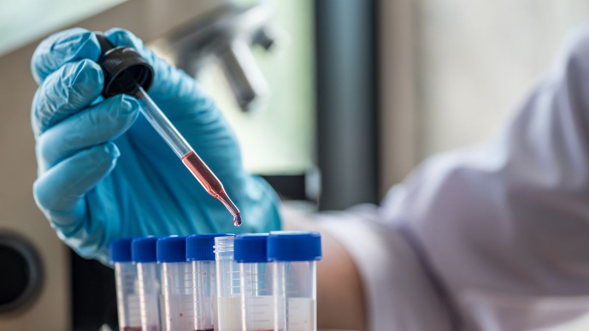 Zasadowica metaboliczna może być związana ze zwiększoną utratą jonów wodorowych