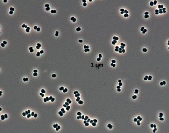 Ta bakteria "udaje martwą". NASA przypadkiem wysłała ją na Marsa