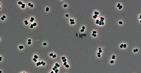 Ta bakteria "udaje martwą". NASA przypadkiem wysłała ją na Marsa