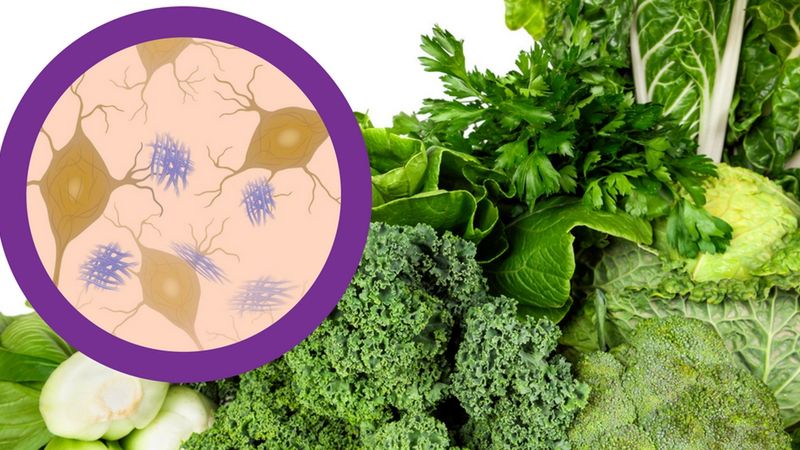 Komórki zaatakowane chorobą Alzheimera razem z zielonymi warzywami, zasobnymi w żelazo, które powoduje chorobę Alzheimera