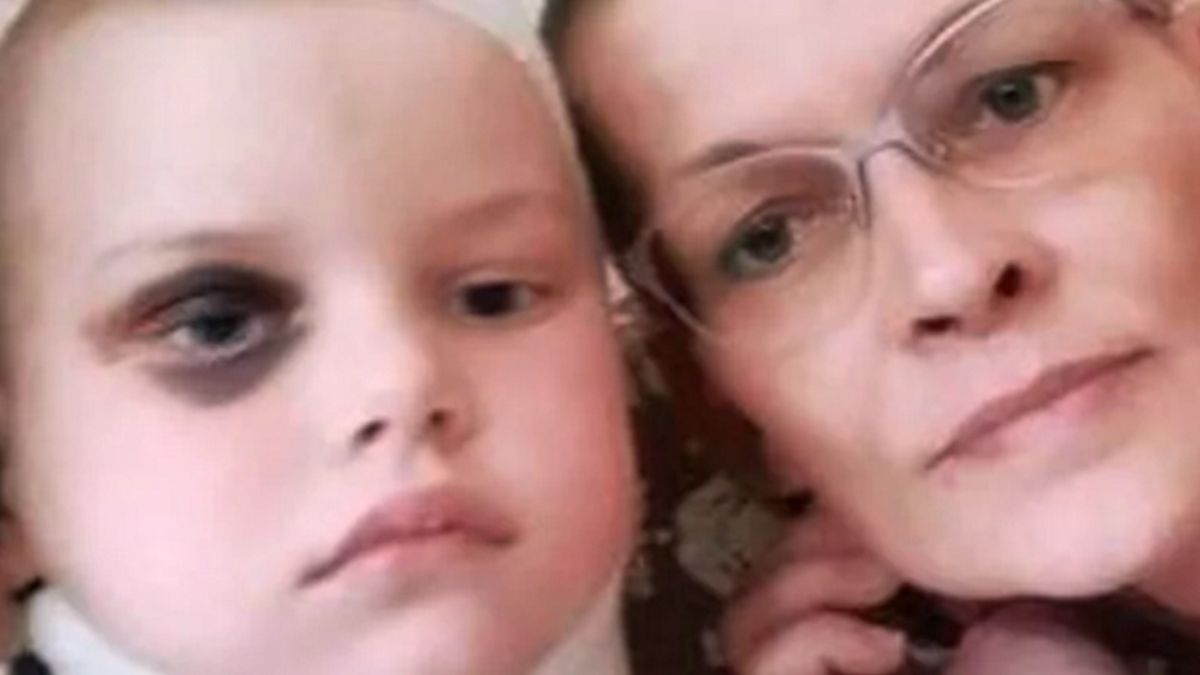 Marysia została przygnieciona przez nagrobek