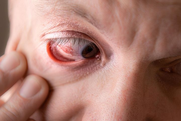 Na udar mogą wskazywać nagłe problemy ze wzrokiem