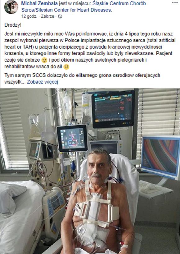 Pacjent, któremu wszczepiono sztuczne serce dochodzi do siebie