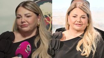 Katarzyna Niezgoda otwiera się na temat paraliżu nerwu twarzowego. Ujawniła też, dlaczego zrobiła LIFTING