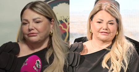 Katarzyna Niezgoda otwiera się na temat paraliżu nerwu twarzowego. Ujawniła też, dlaczego zrobiła LIFTING