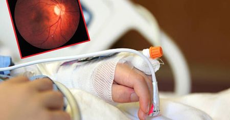 Prysnął siostrze w oko detergentem. 3-latka może stracić wzrok