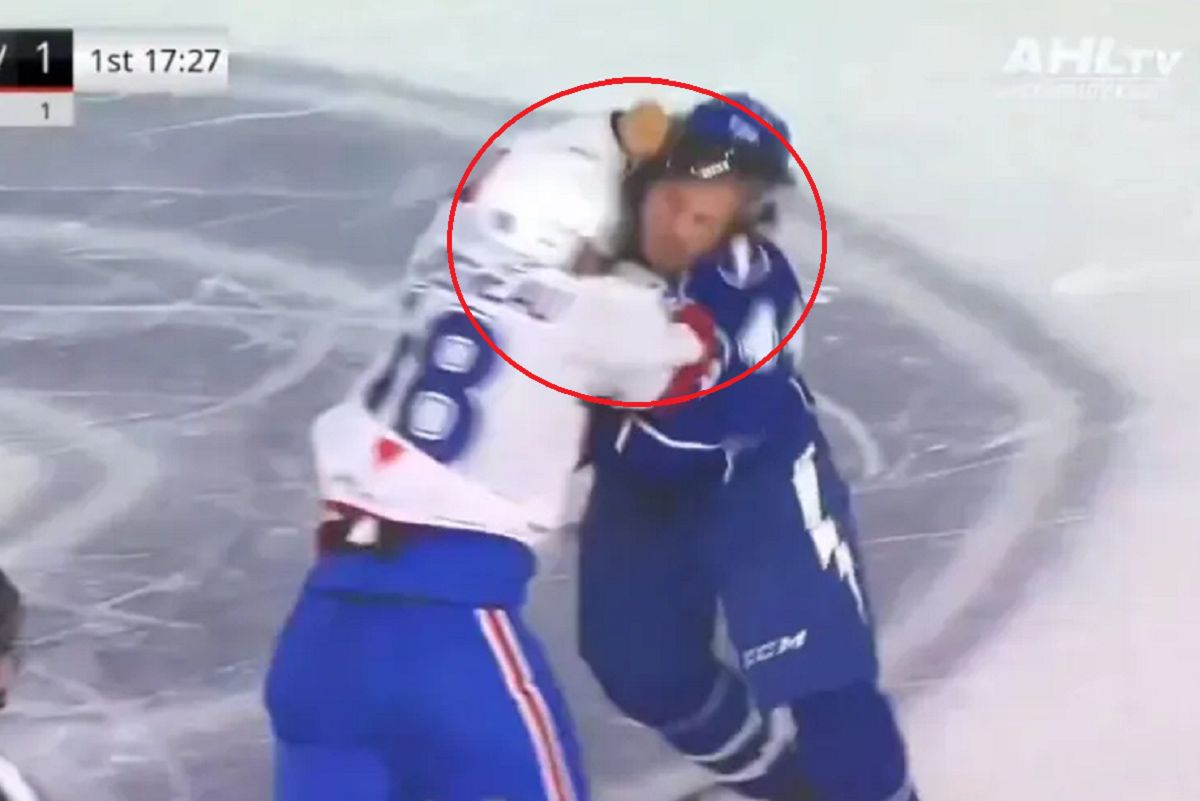 Shocking scenes in hockey. After the brawl, he could have lost a finger.