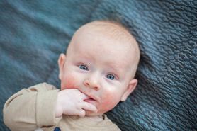 Objawy alergii na soję u niemowląt
