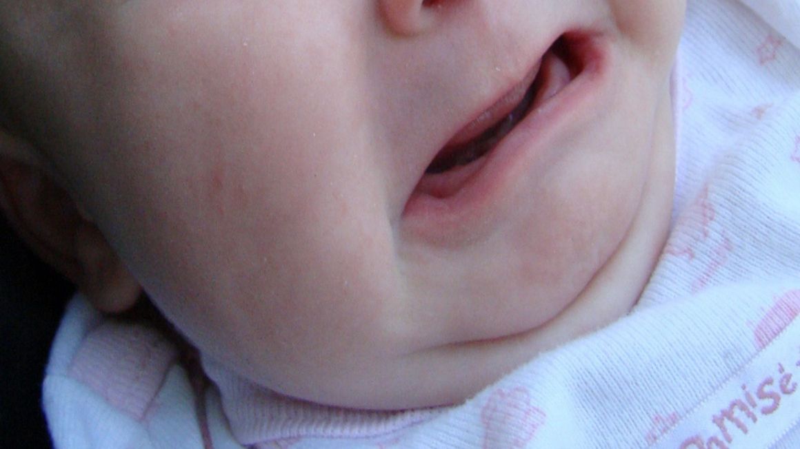 5-letnia dziewczynka podczas picia wody ze swojej nowej butelki poczuła, że jej język utknął w butelce.