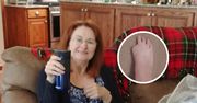 Straciła palca u stopy przez pedicure. Ma ważną radę