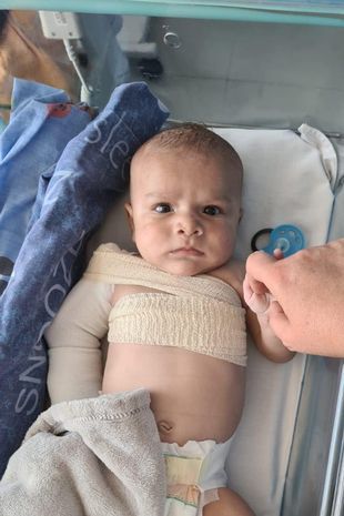 Niemowlę trafiło do szpitala po tym, jak skoczył na nie pies