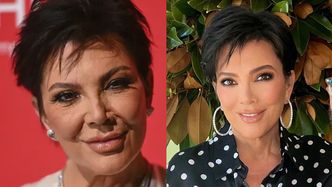 Kris Jenner przesadziła z RETUSZEM?! Fani są w szoku: "To NIE JEST jej twarz!" (FOTO)