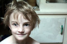 Anemia u dzieci - przyczyny, leczenie