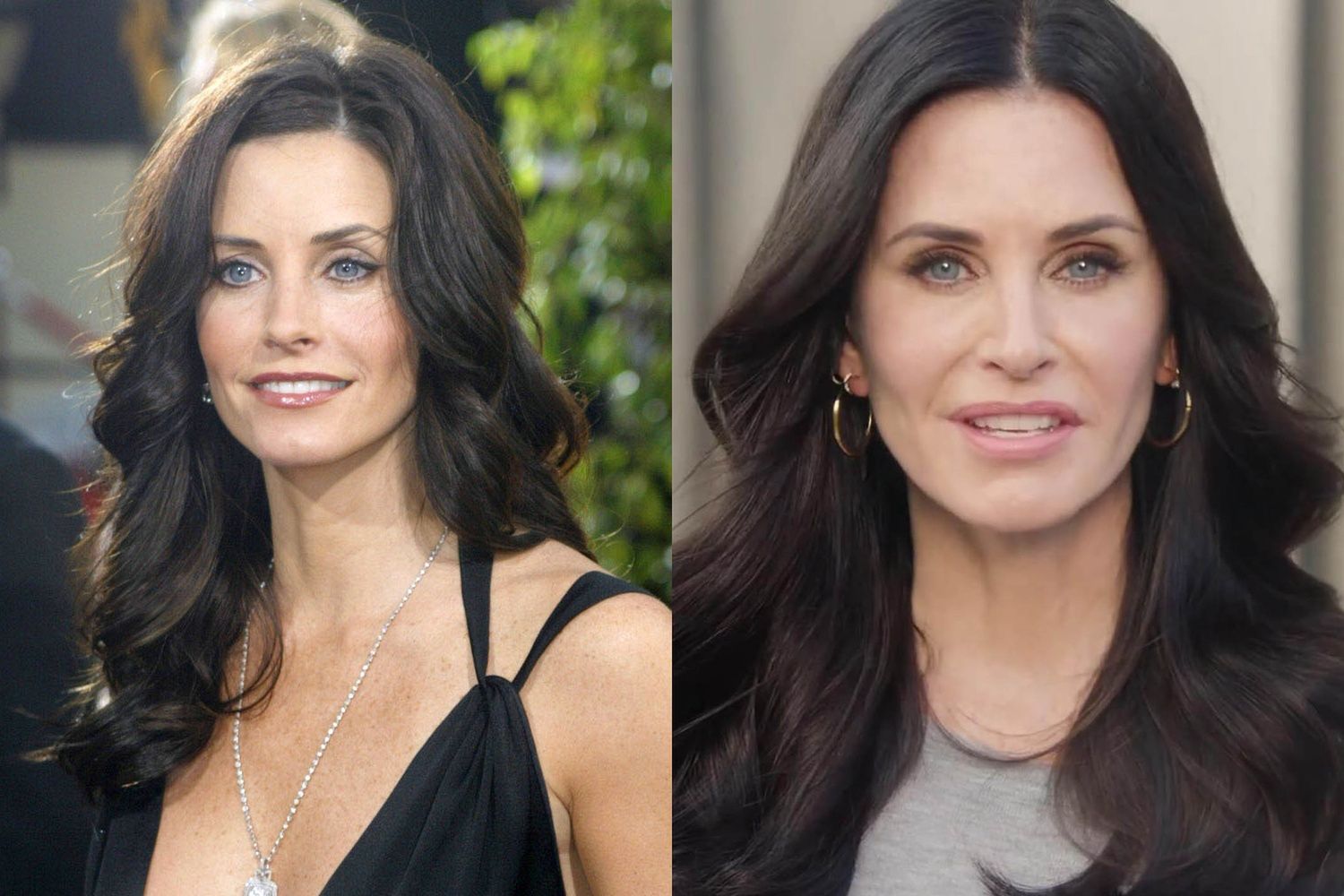 Courteney Cox i medycyna estetyczna