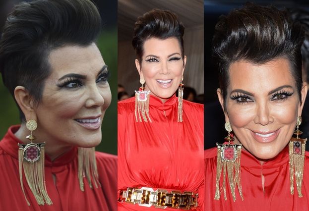 Co się stało z twarzą matki Kim Kardashian? (ZDJĘCIA)