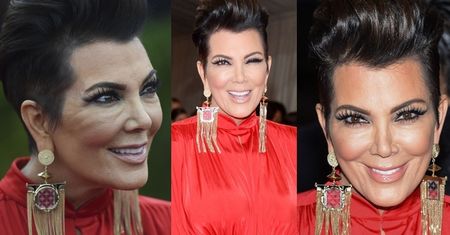 Co się stało z twarzą matki Kim Kardashian? (ZDJĘCIA)