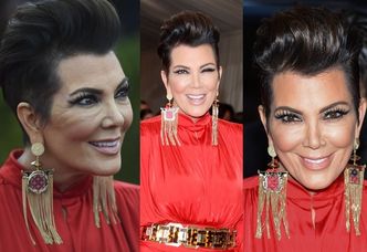 Co się stało z twarzą matki Kim Kardashian? (ZDJĘCIA)
