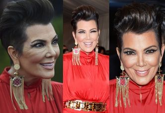 Co się stało z twarzą matki Kim Kardashian? (ZDJĘCIA)