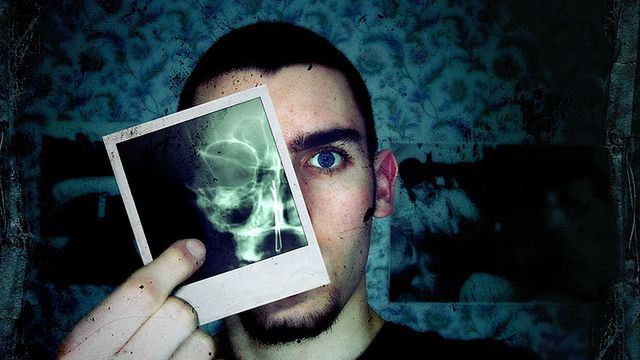 Przenośny rentgen - mobilne urządzenie, które ratuje życie [wideo] 1