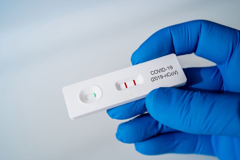 Test na obecność koronawirusa będzie można zrobić w aptece 