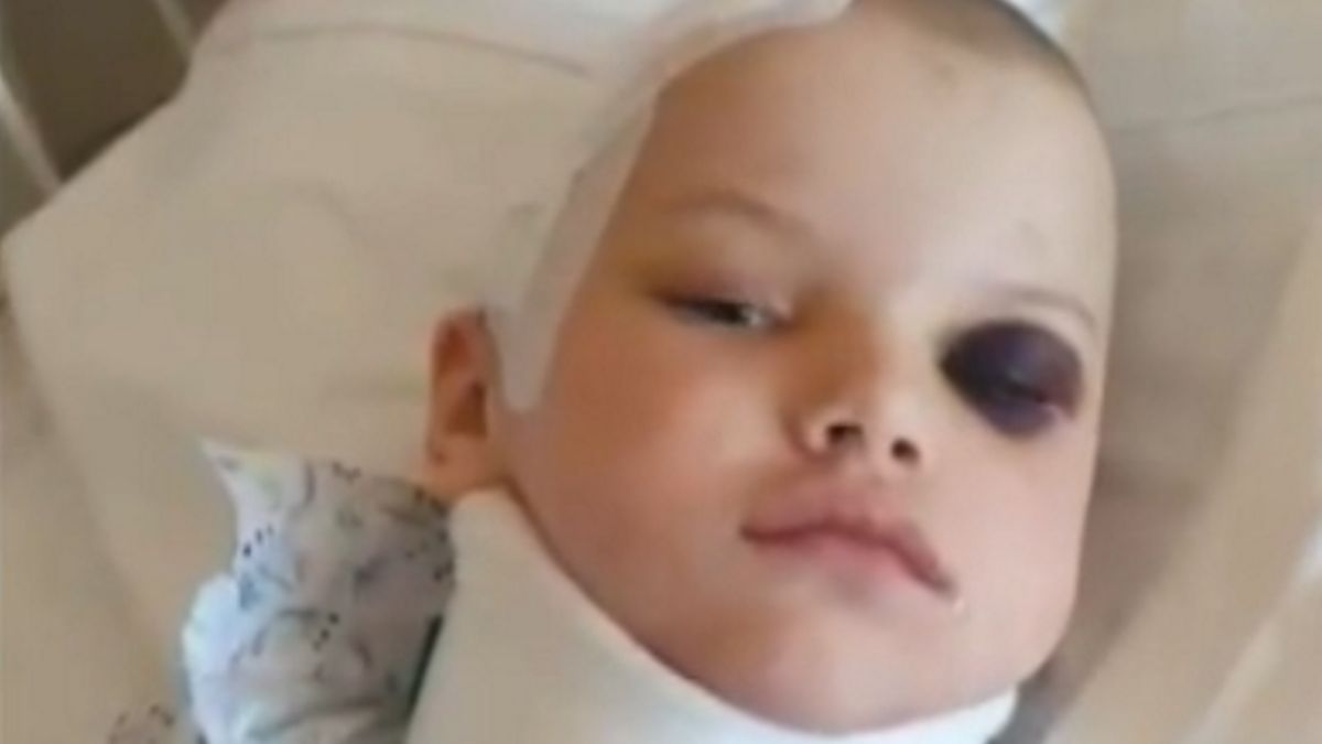 Na 5-letnią Marysię runął duży betonowy krzyż z sąsiedniego starego nagrobka. Dziewczynka w stanie krytycznym trafiła do szpitala.