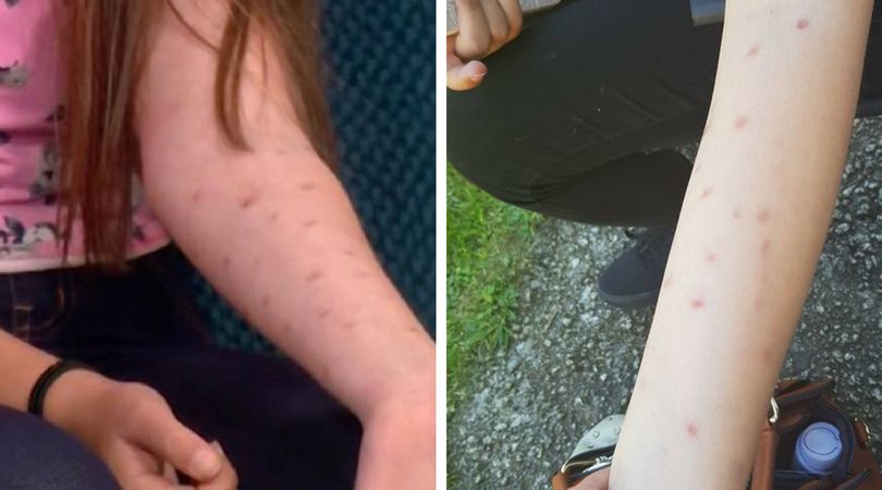 "Deodorant challenge" - nowy trend wśród nastolatków