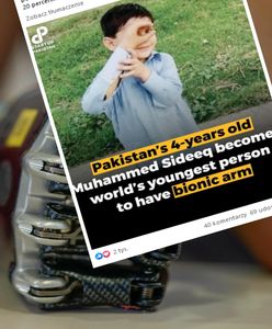 Pakistan. Najmłodszy człowiek z bionicznym ramieniem na świecie