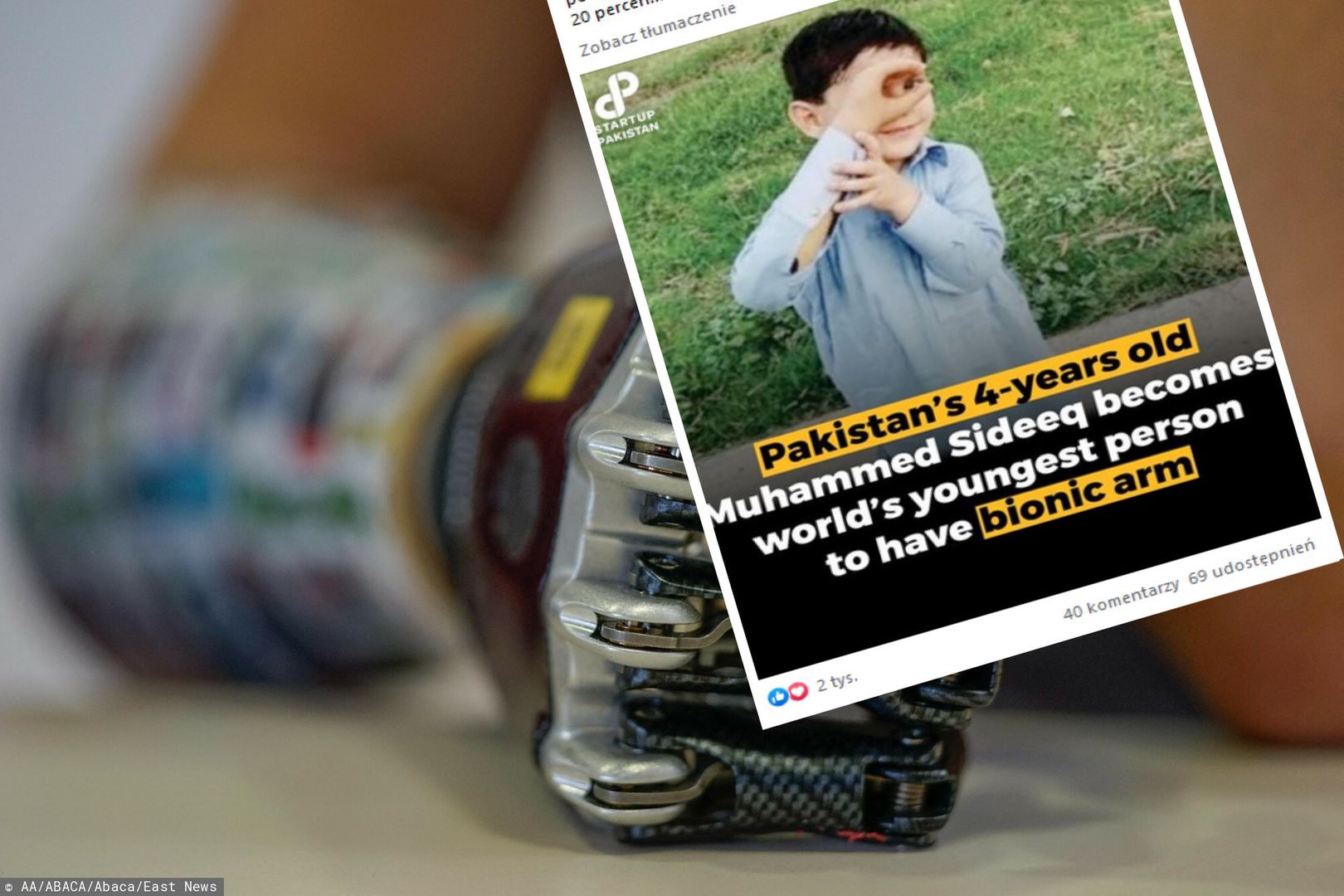 Pakistan. Najmłodszy człowiek z bionicznym ramieniem na świecie
