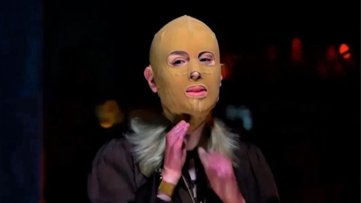 Australijka po raz pierwszy pokazała publicznie swoją poparzoną twarz 