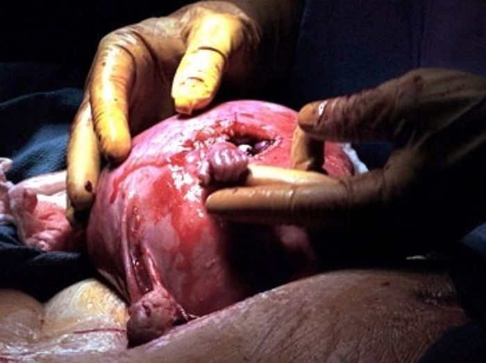 "Hand of hope". Dziecko ze słynnego zdjęcia ma już 21 lat. Co dziś robi Samuel Armas?