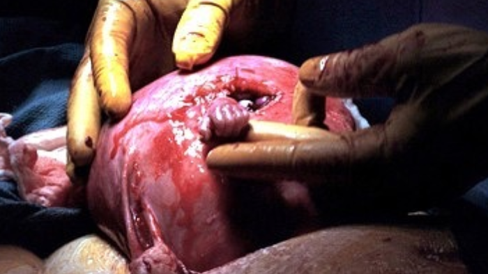 Hand of hope
