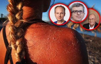 Tak Polacy generują raka w wakacje. "Nagła i intensywna ekspozycja"