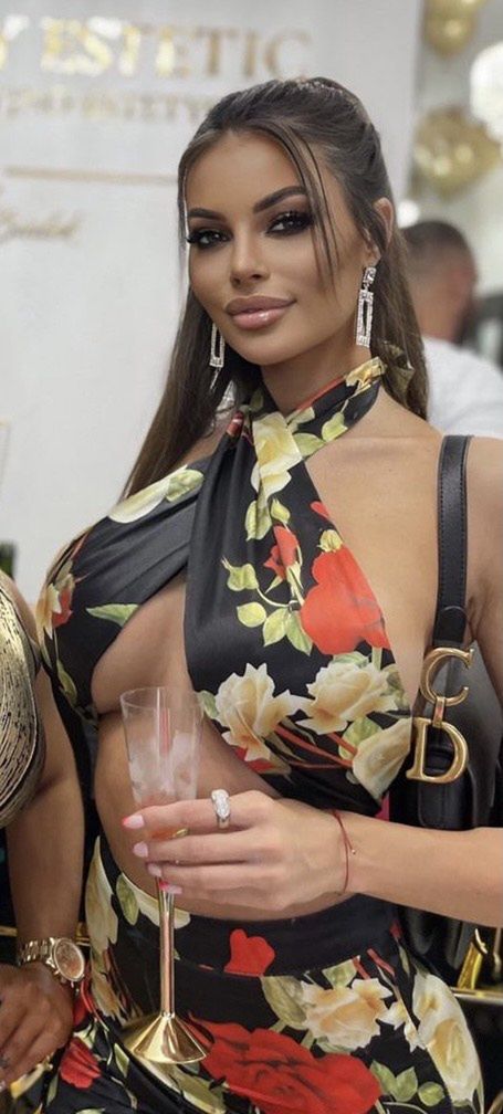 Justyna Gradek i jej eks Karol Miśkiewicz wspólnie promują salon medycyny estetycznej. Przekonali was?