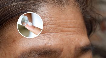 Niezawodna maść na zmarszczki. Bije na głowę drogie kremy