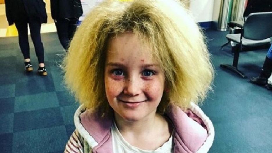 Dziewczynka cierpi na rzadkie schorzenie